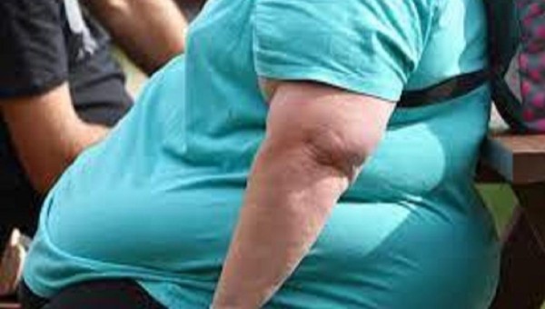 AUMENTO DA OBESIDADE PREOCUPA ESPECIALISTAS
